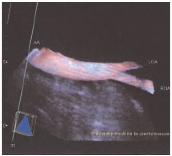 Cardiovascmed 07 00423 g006