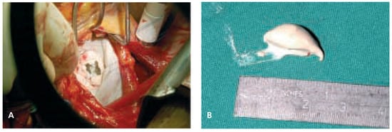 Cardiovascmed 08 00062 g002