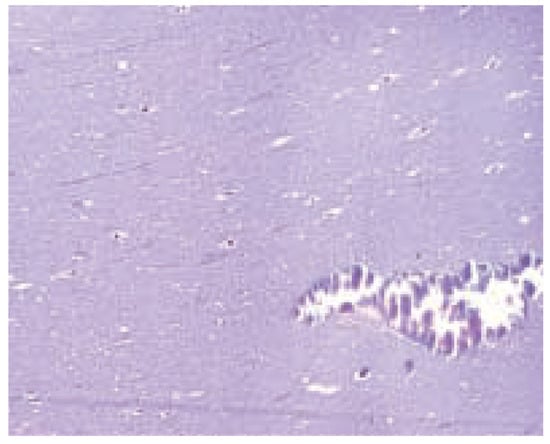 Cardiovascmed 08 00062 g003