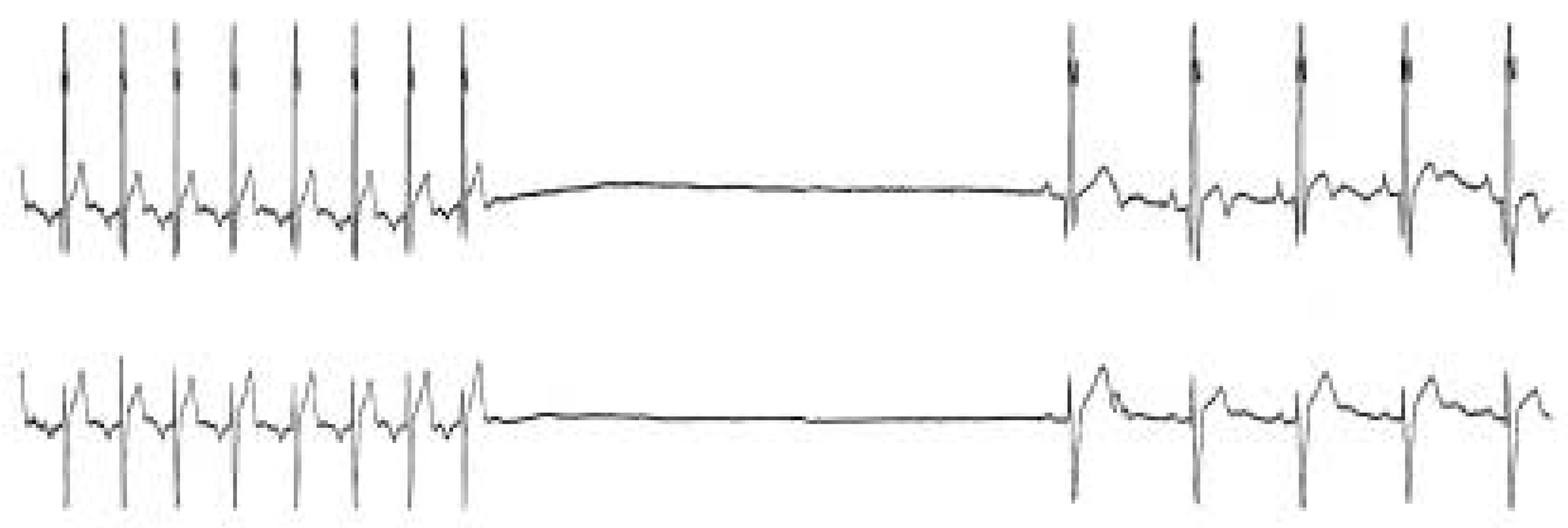 Cardiovascmed 08 00064 g002