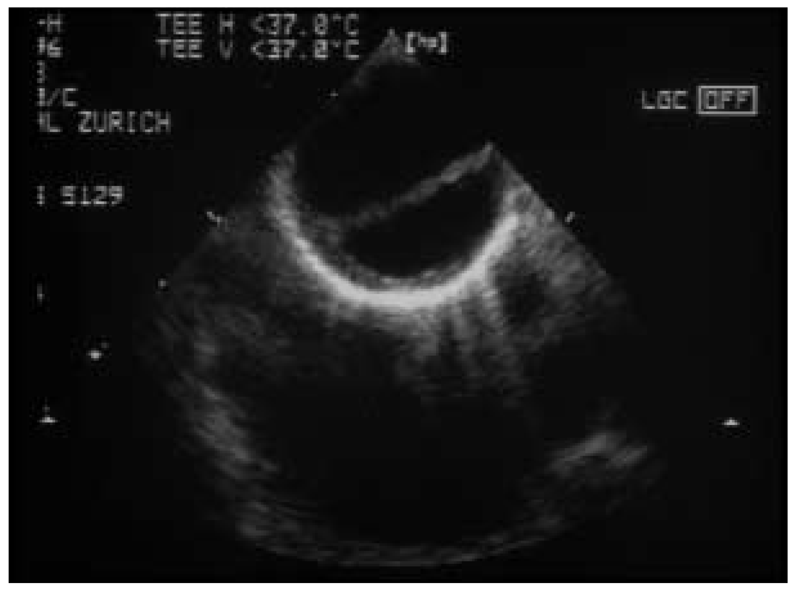 Cardiovascmed 08 00079 g001
