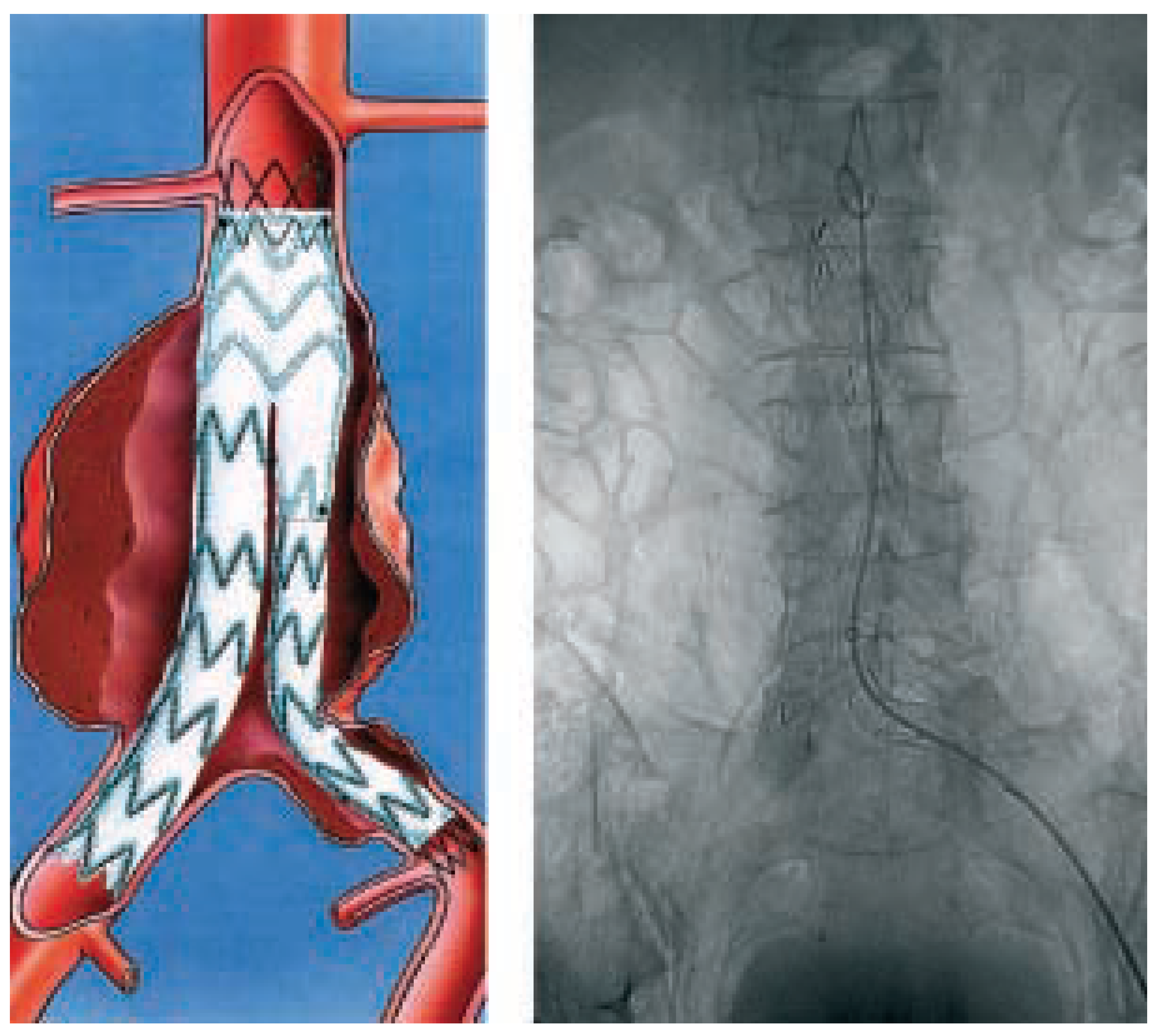 Cardiovascmed 08 00079 g003