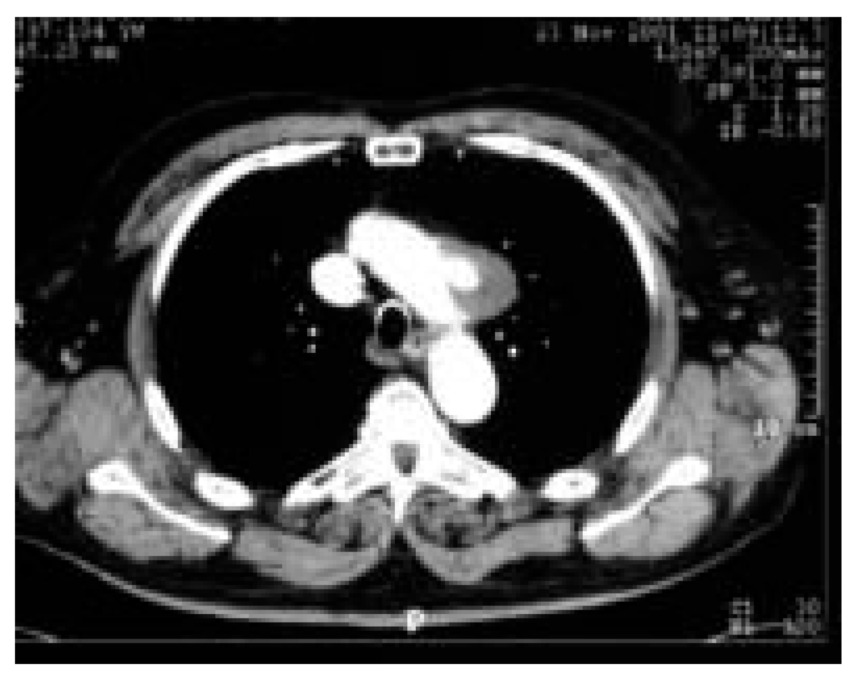 Cardiovascmed 08 00082 g001