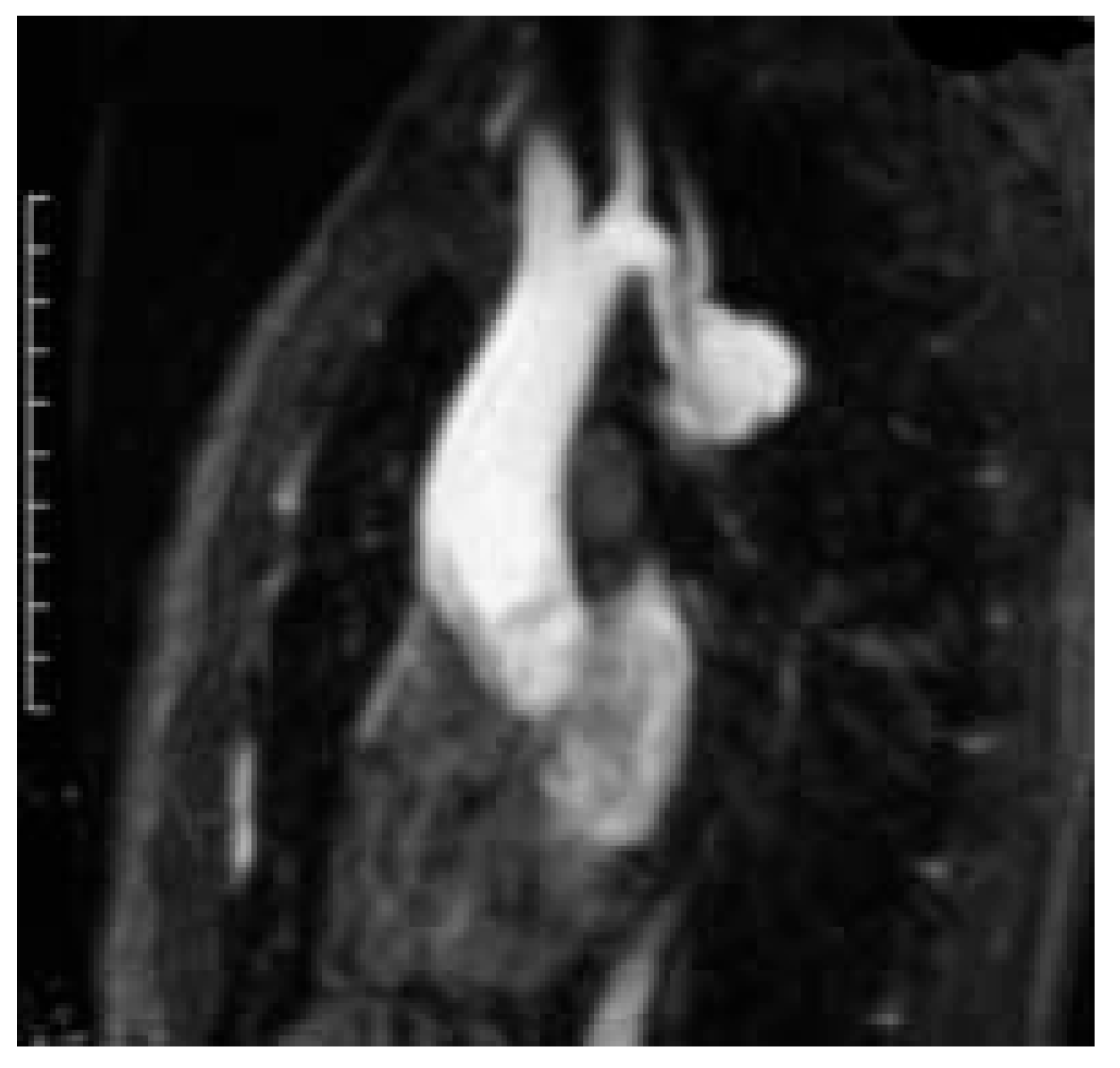 Cardiovascmed 08 00082 g002