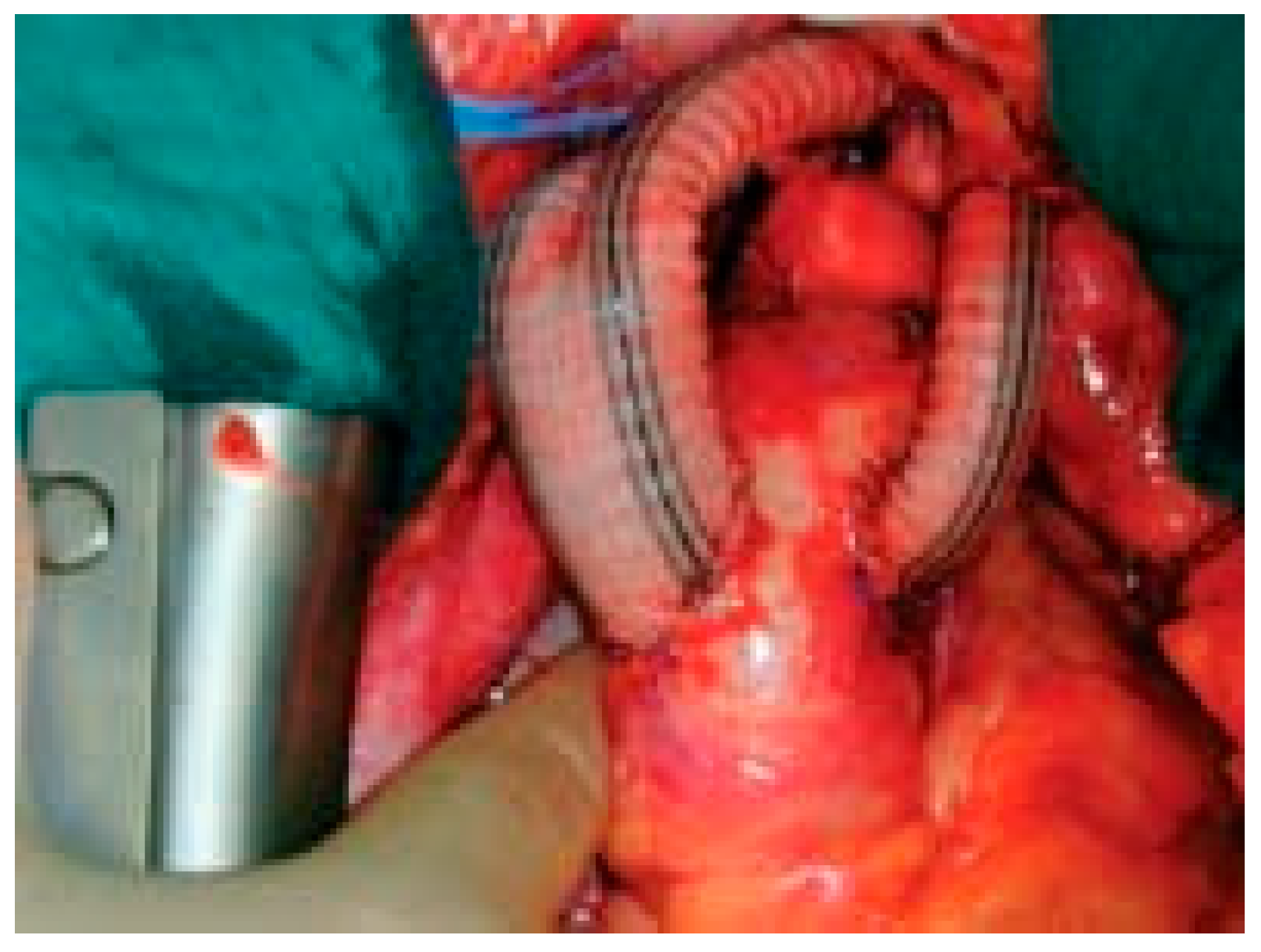 Cardiovascmed 08 00082 g004