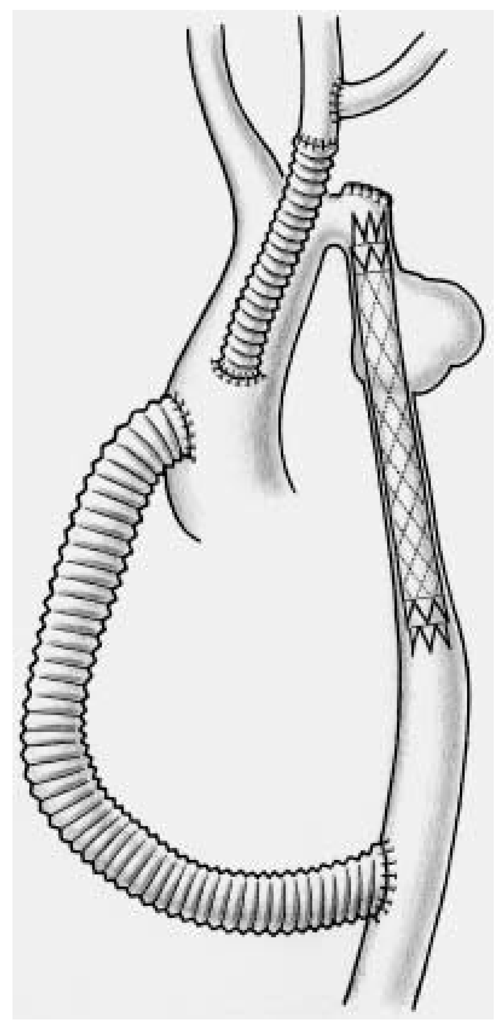 Cardiovascmed 08 00082 g005