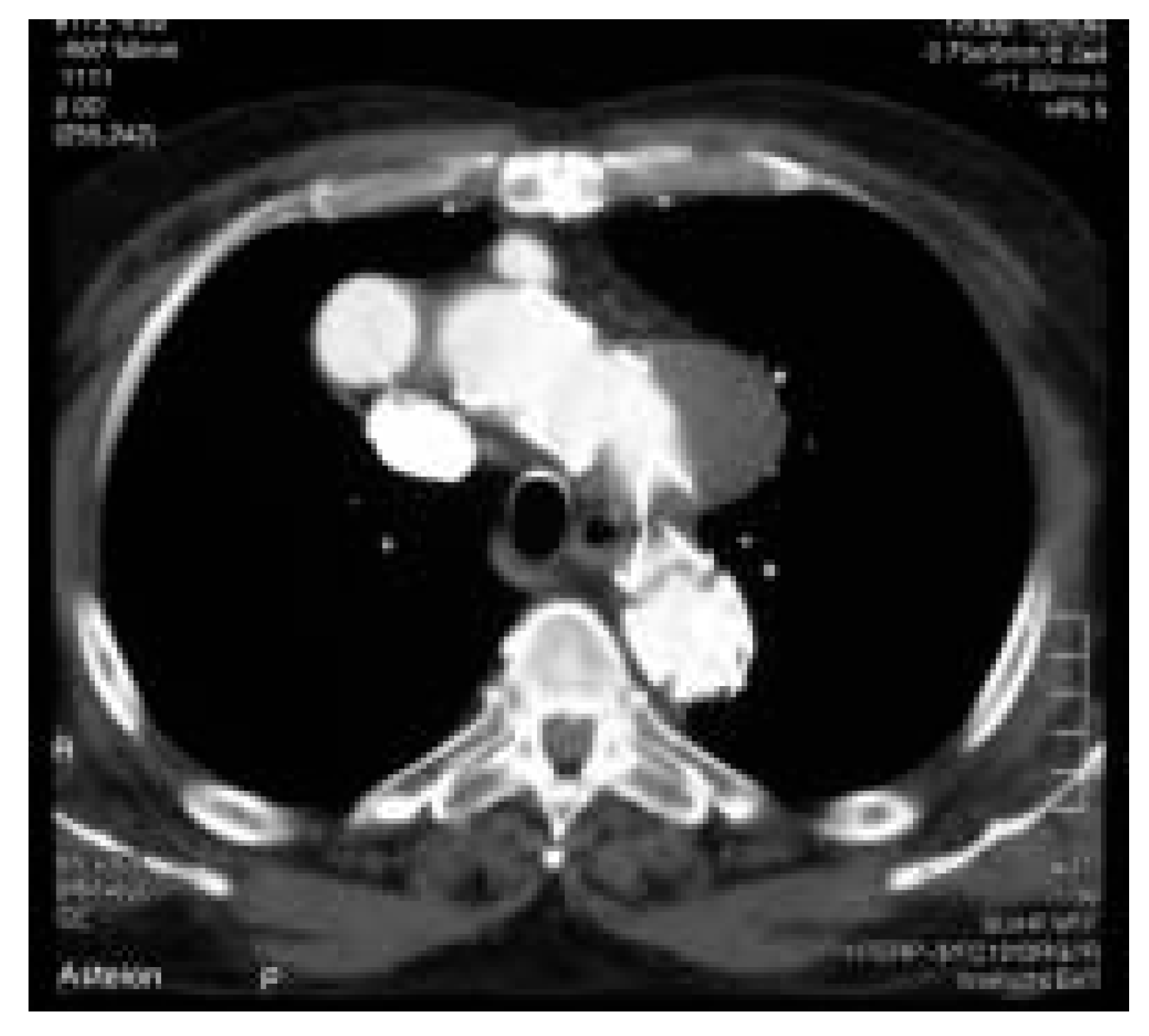 Cardiovascmed 08 00082 g006