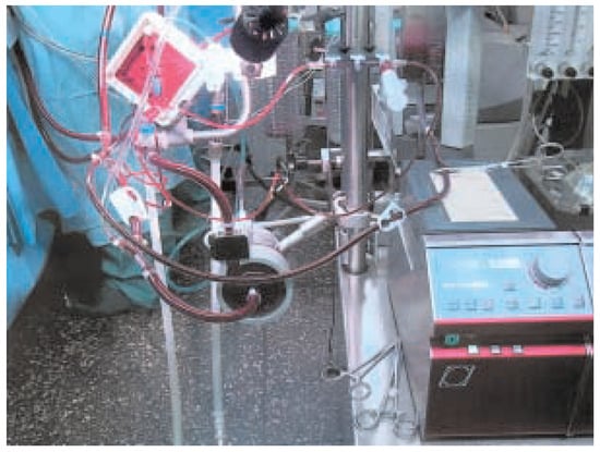 Cardiovascmed 08 00172 g009