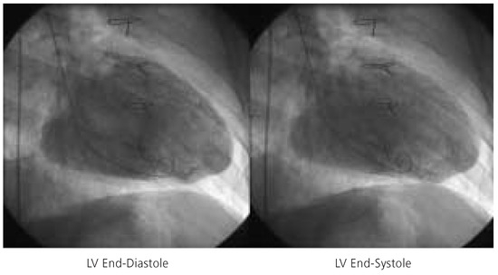 Cardiovascmed 08 00187 g003