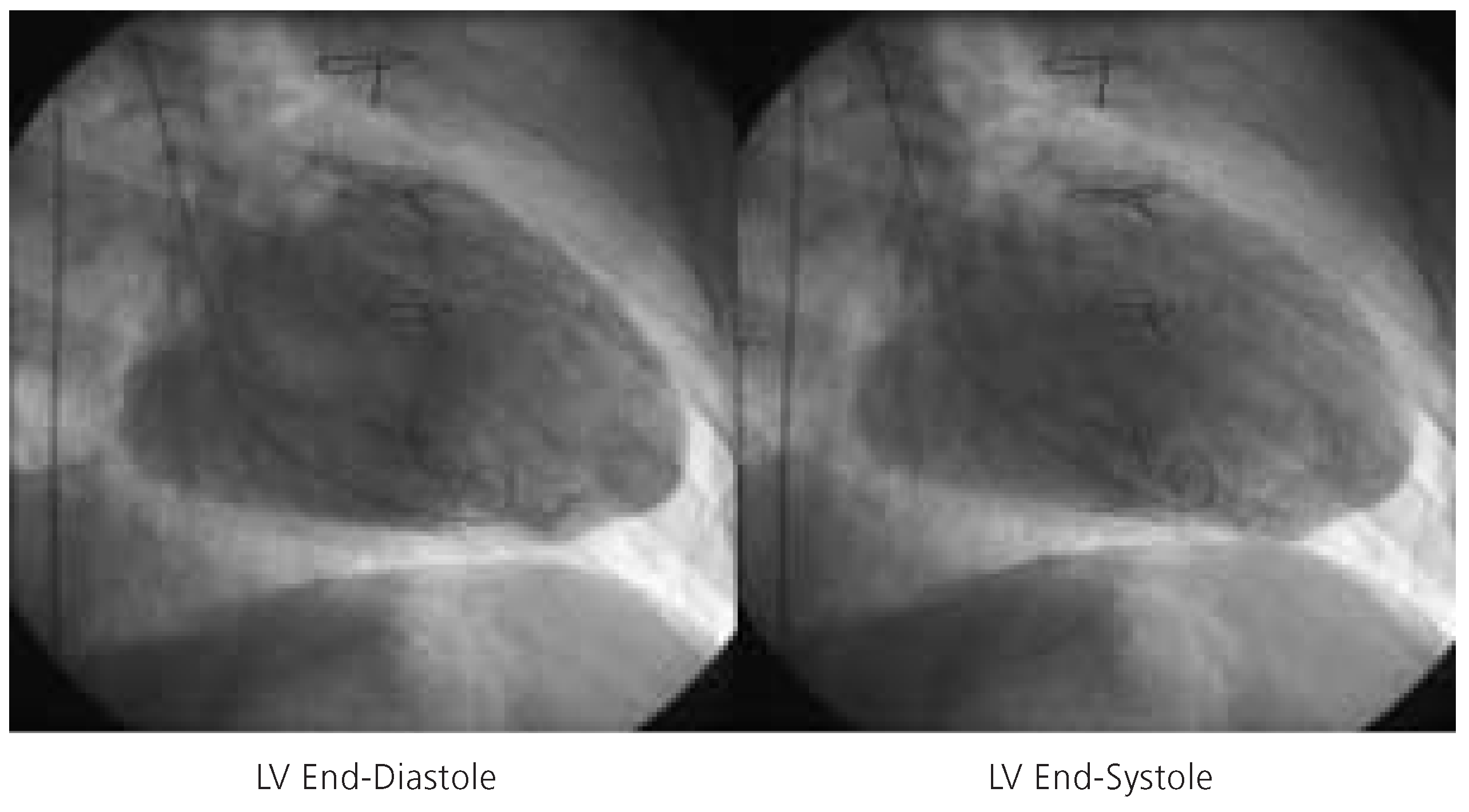 Cardiovascmed 08 00187 g003