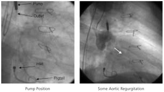 Cardiovascmed 08 00187 g004