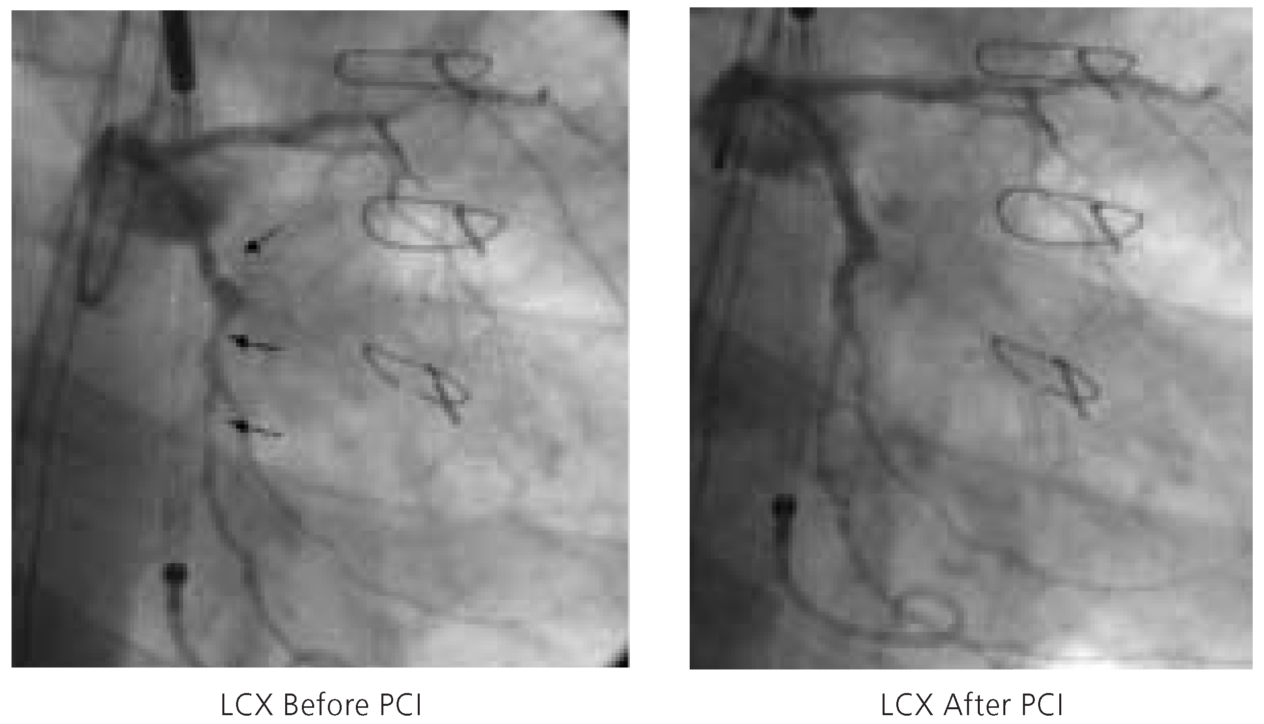 Cardiovascmed 08 00187 g005
