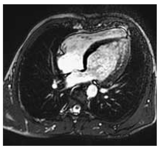 Cardiovascmed 08 00297 g001