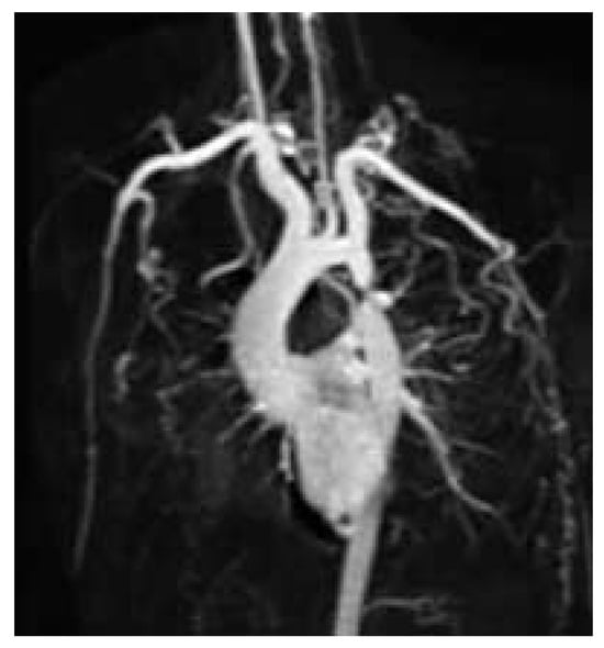 Cardiovascmed 08 00297 g002