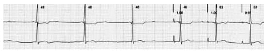 Cardiovascmed 08 00330 g001