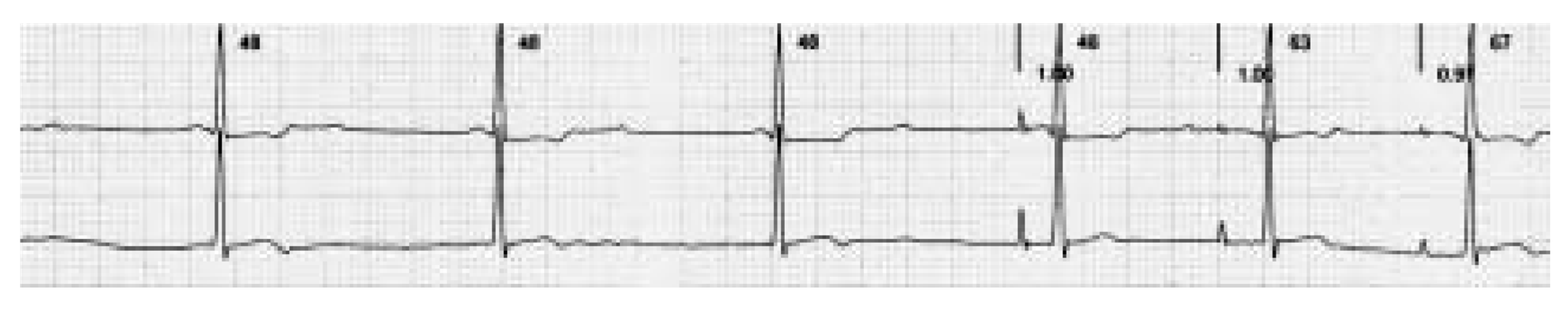 Cardiovascmed 08 00330 g001 Cardiovascmed 08 00330 g001