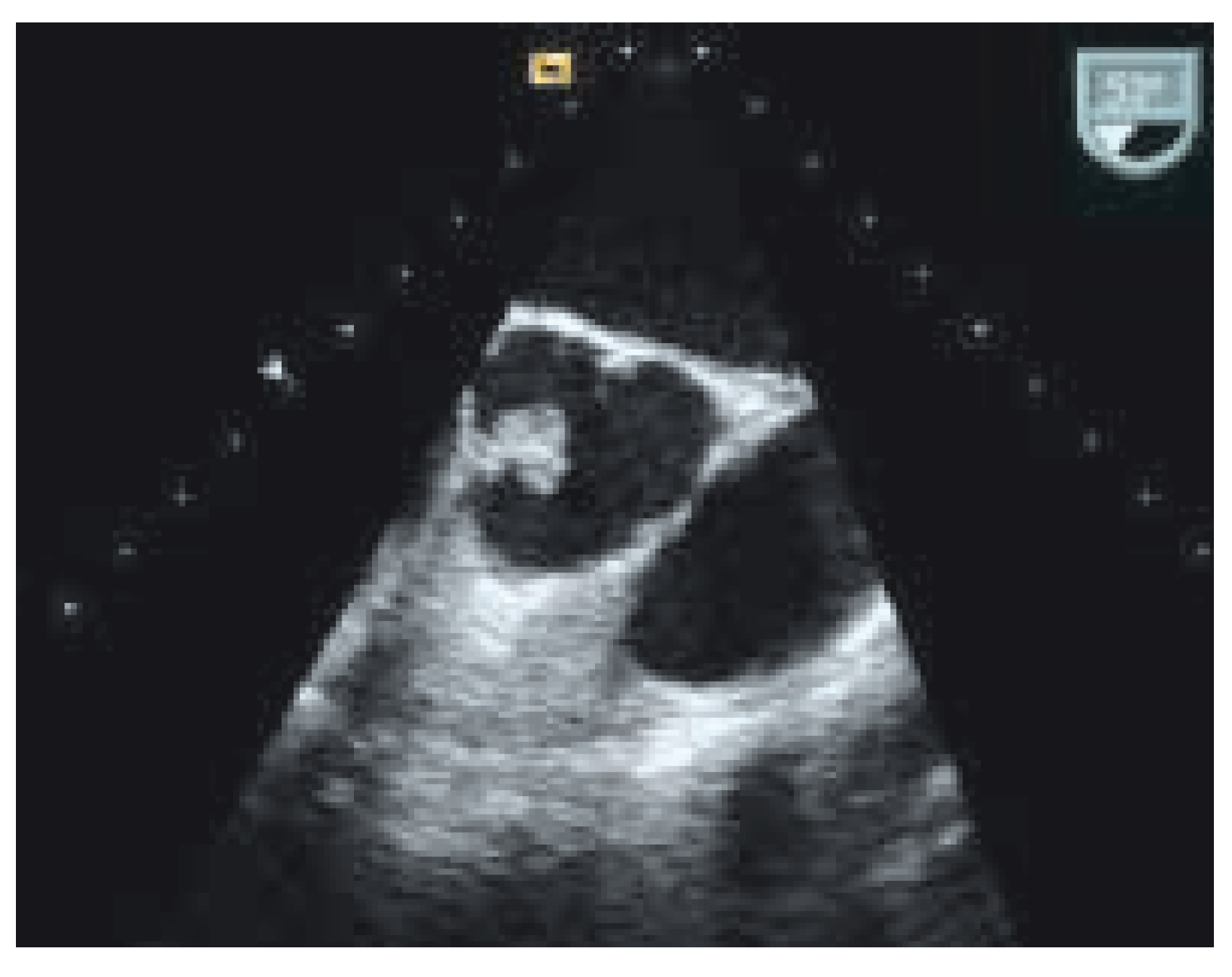 Cardiovascmed 08 00332 g001 Cardiovascmed 08 00332 g001
