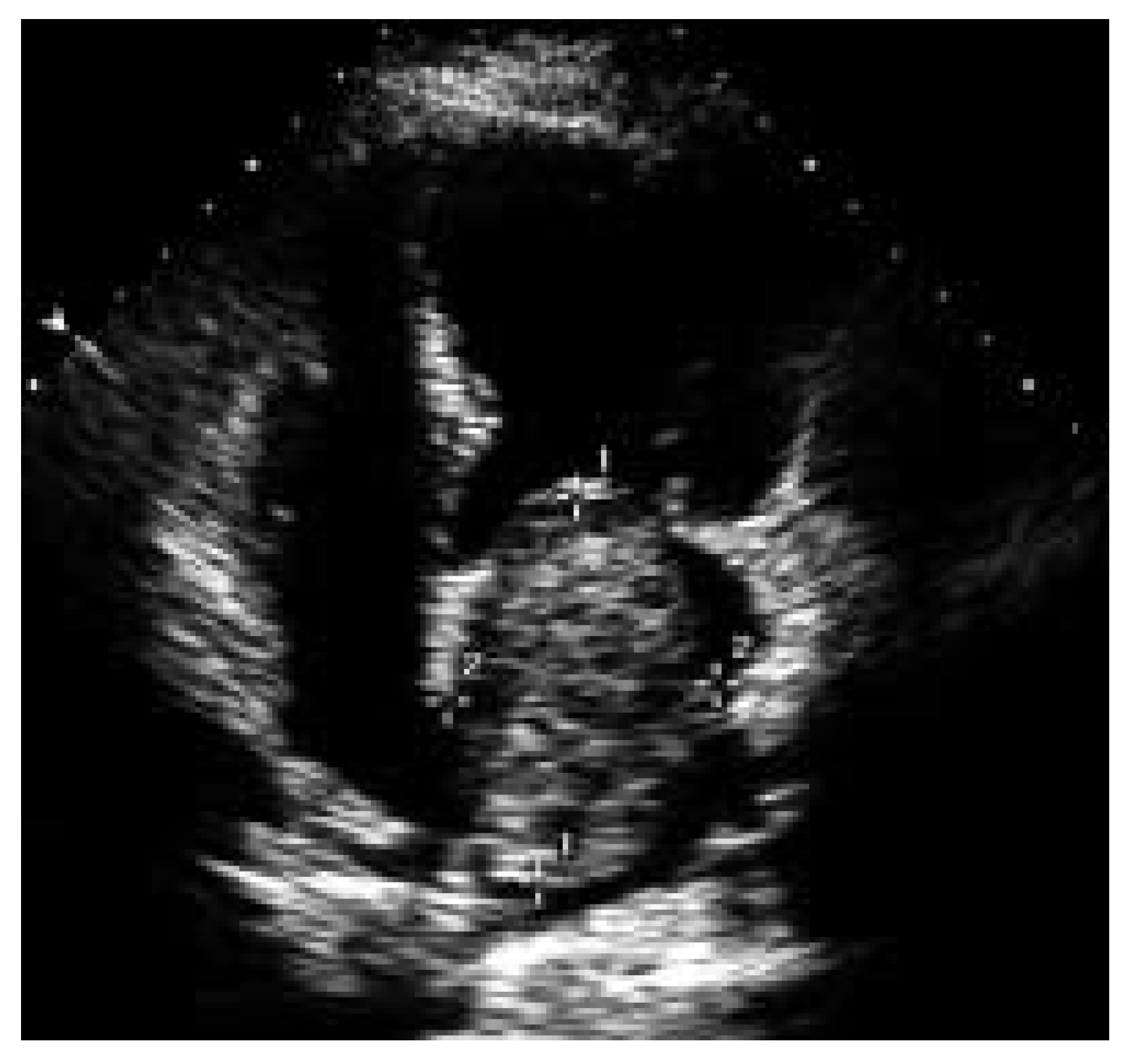 Cardiovascmed 08 00361 g003 Cardiovascmed 08 00361 g003