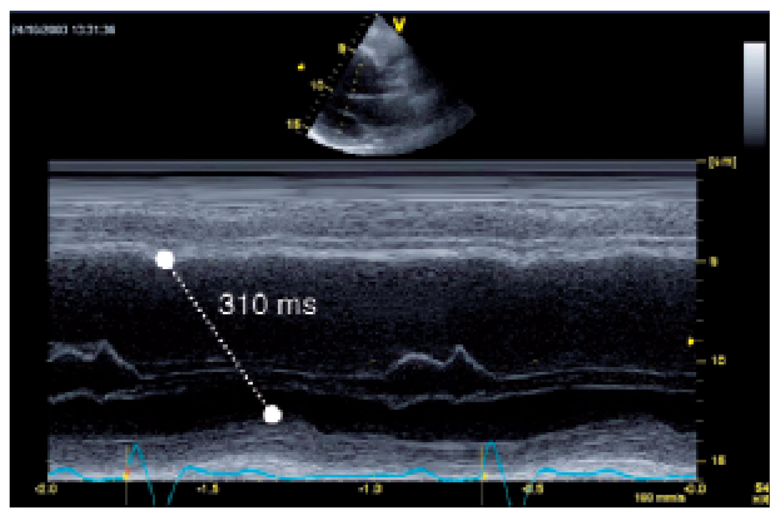Cardiovascmed 08 00426 g001