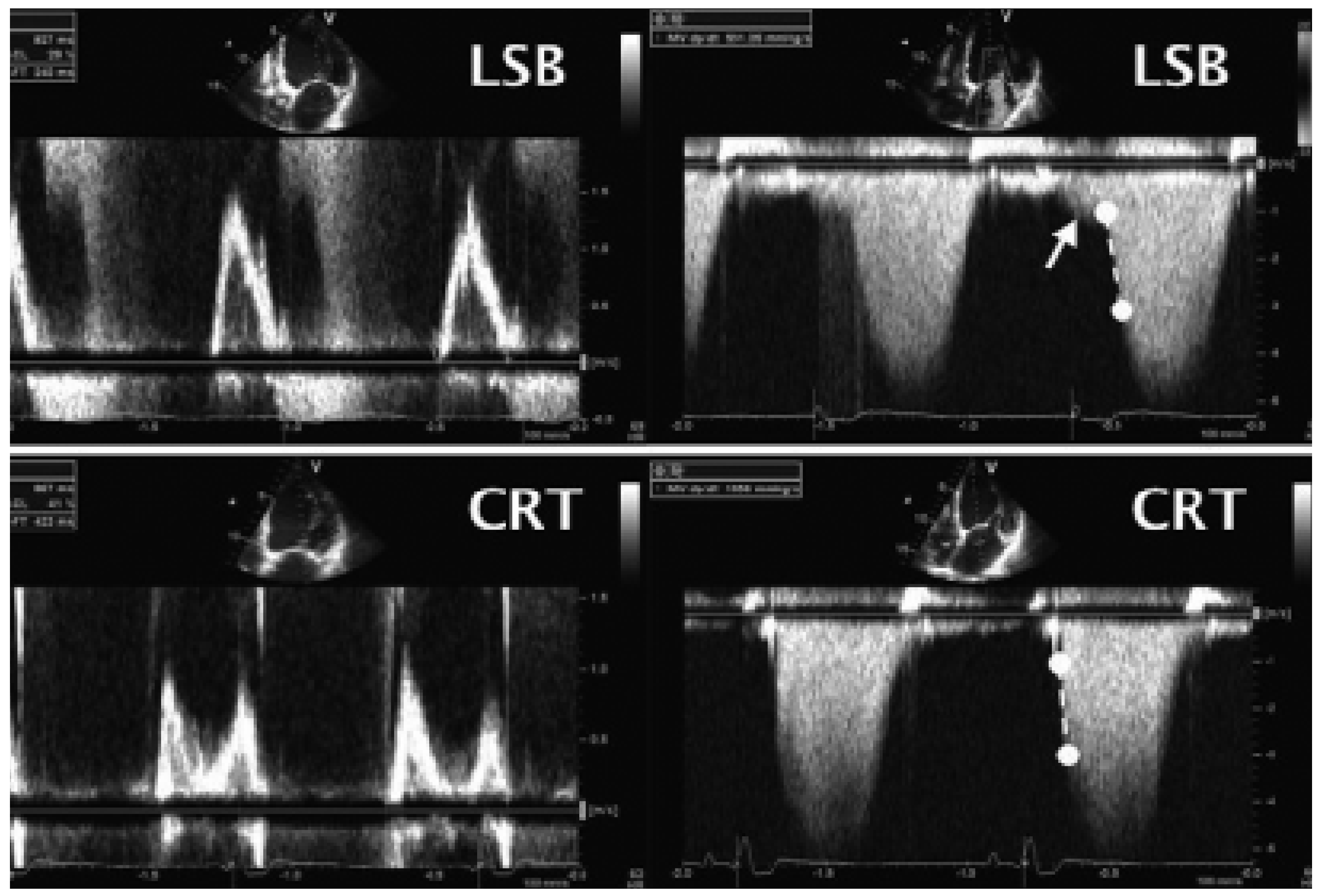 Cardiovascmed 08 00426 g002