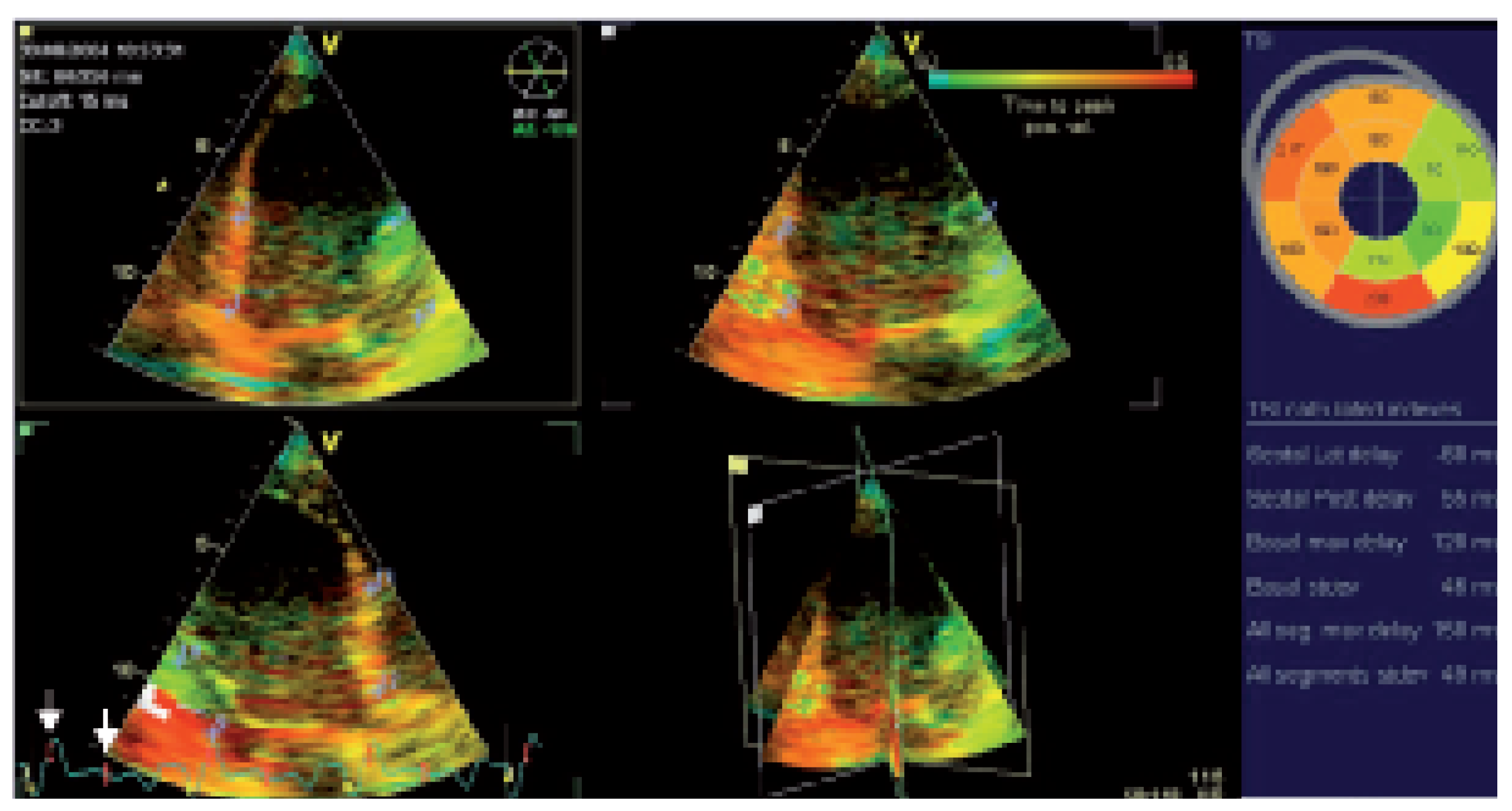 Cardiovascmed 08 00426 g003