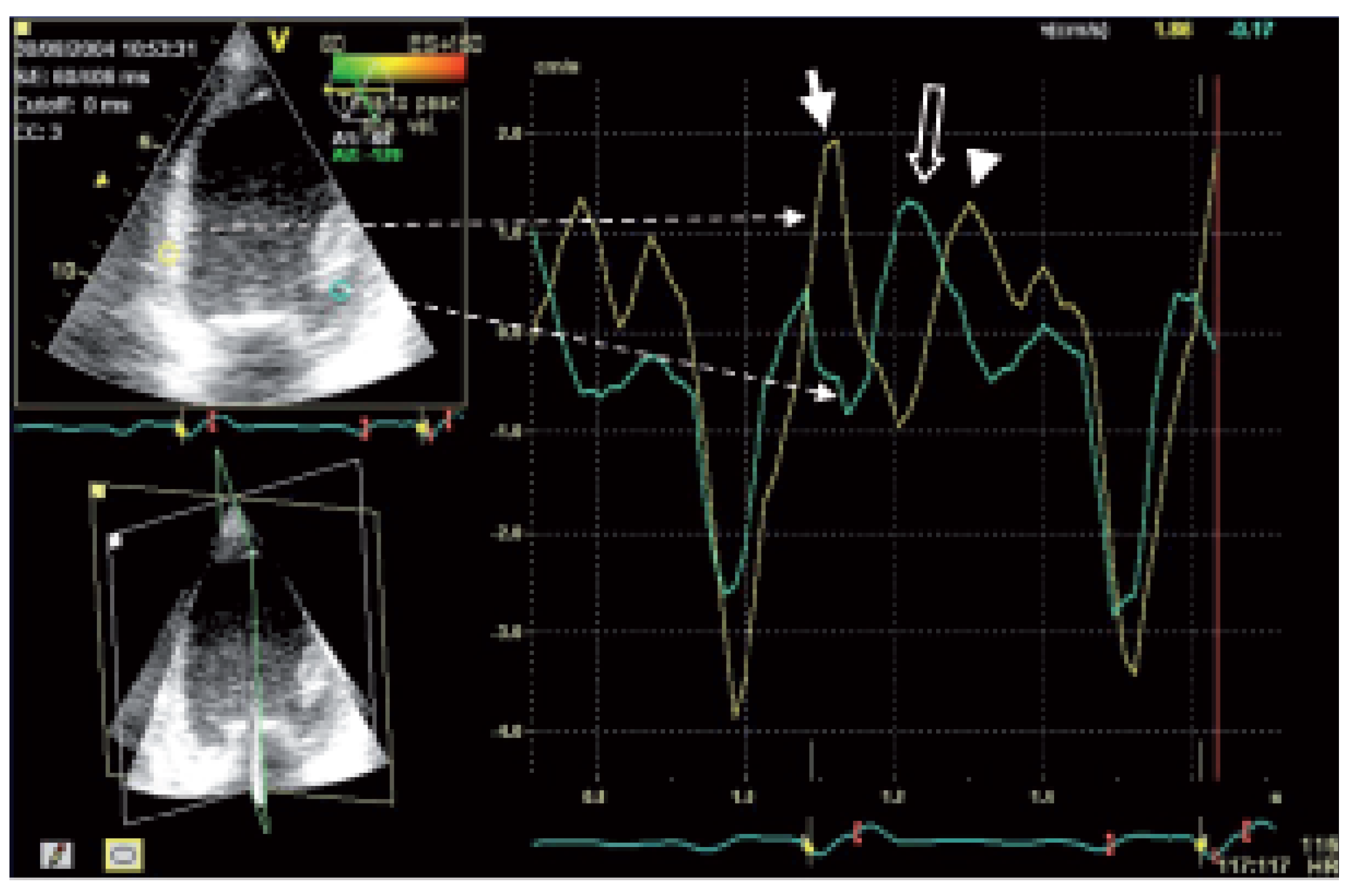 Cardiovascmed 08 00426 g004