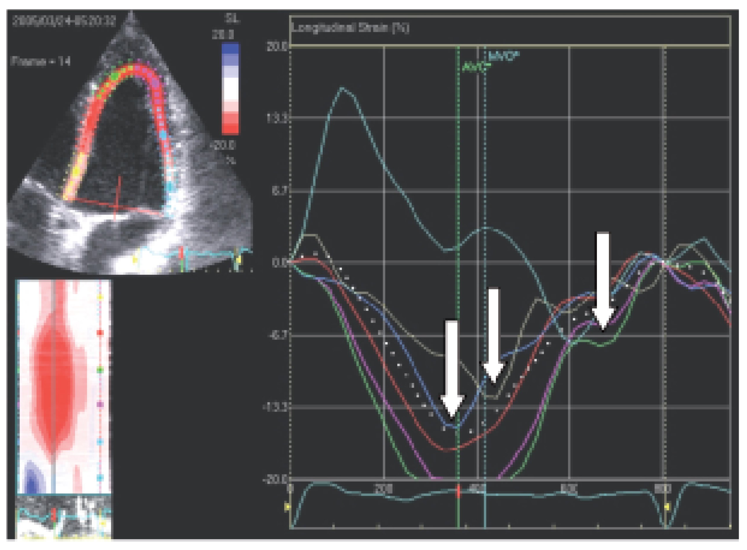 Cardiovascmed 08 00426 g006