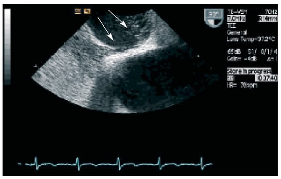 Cardiovascmed 09 00032 g001
