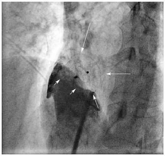 Cardiovascmed 09 00032 g002