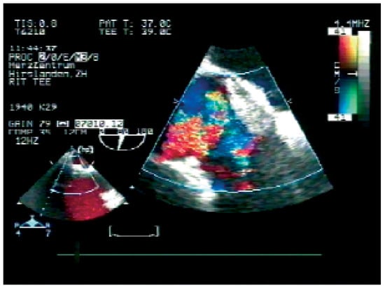 Cardiovascmed 09 00032 g003