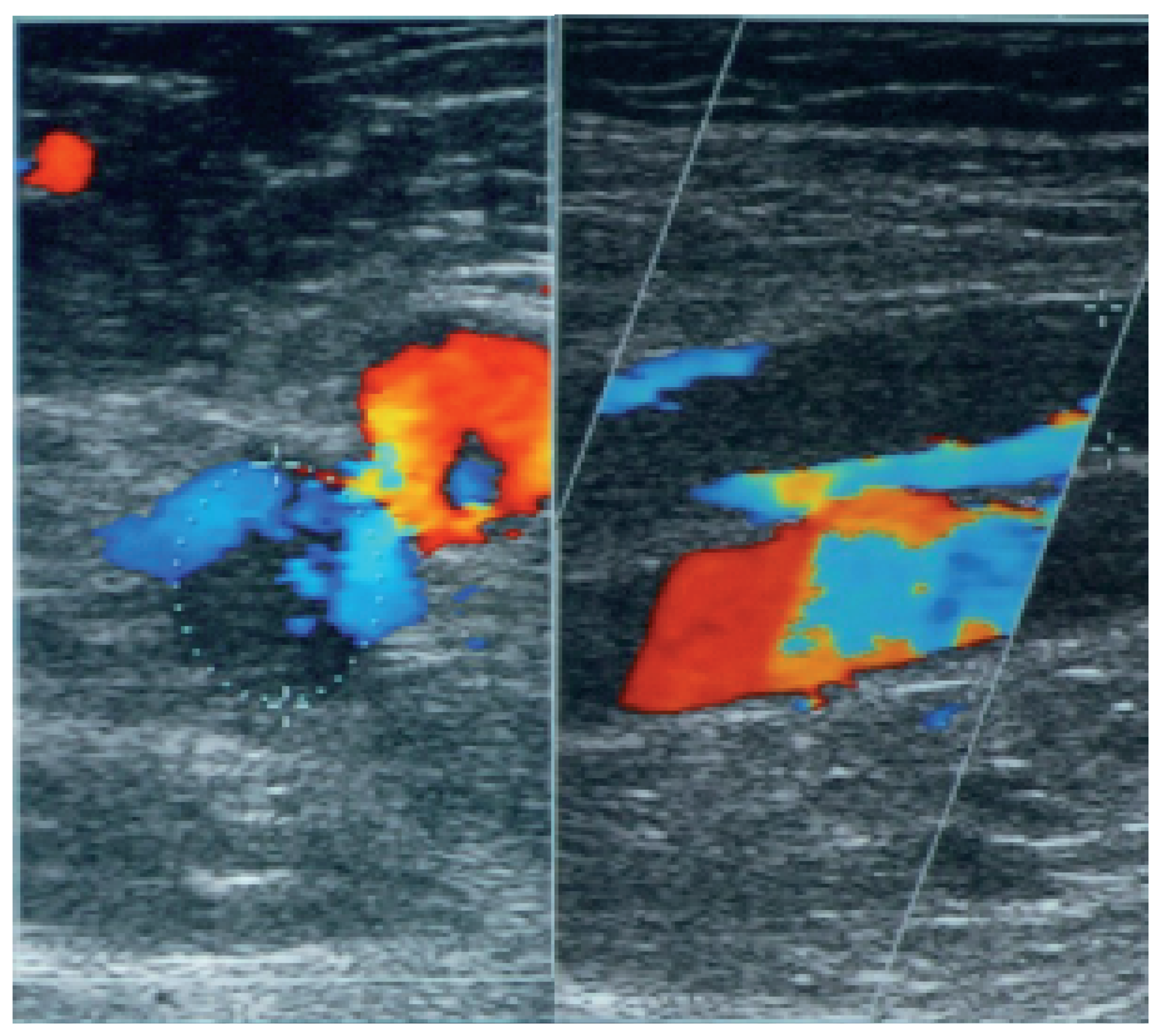 Cardiovascmed 09 00110 g002