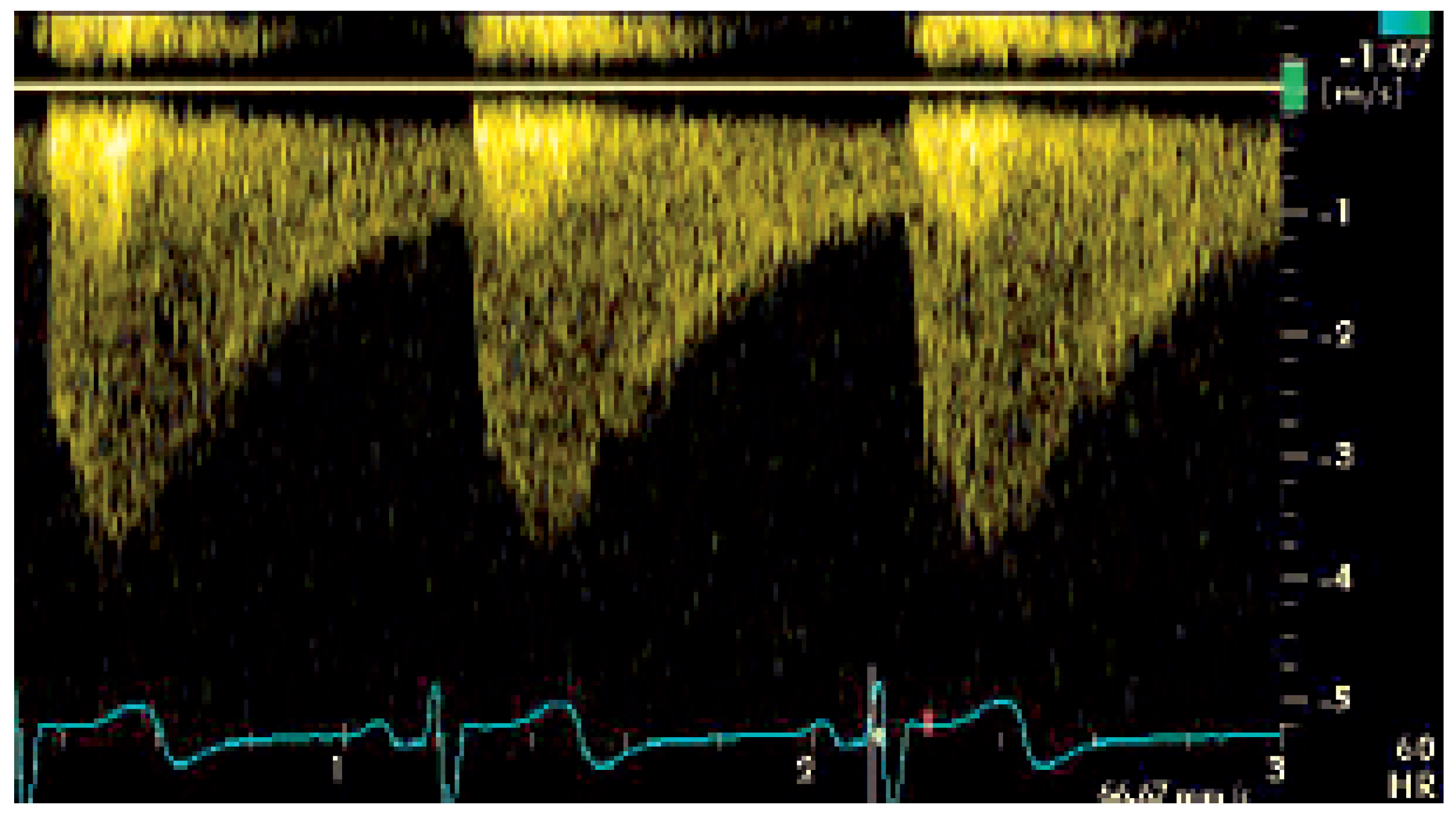 Cardiovascmed 09 00125 g001