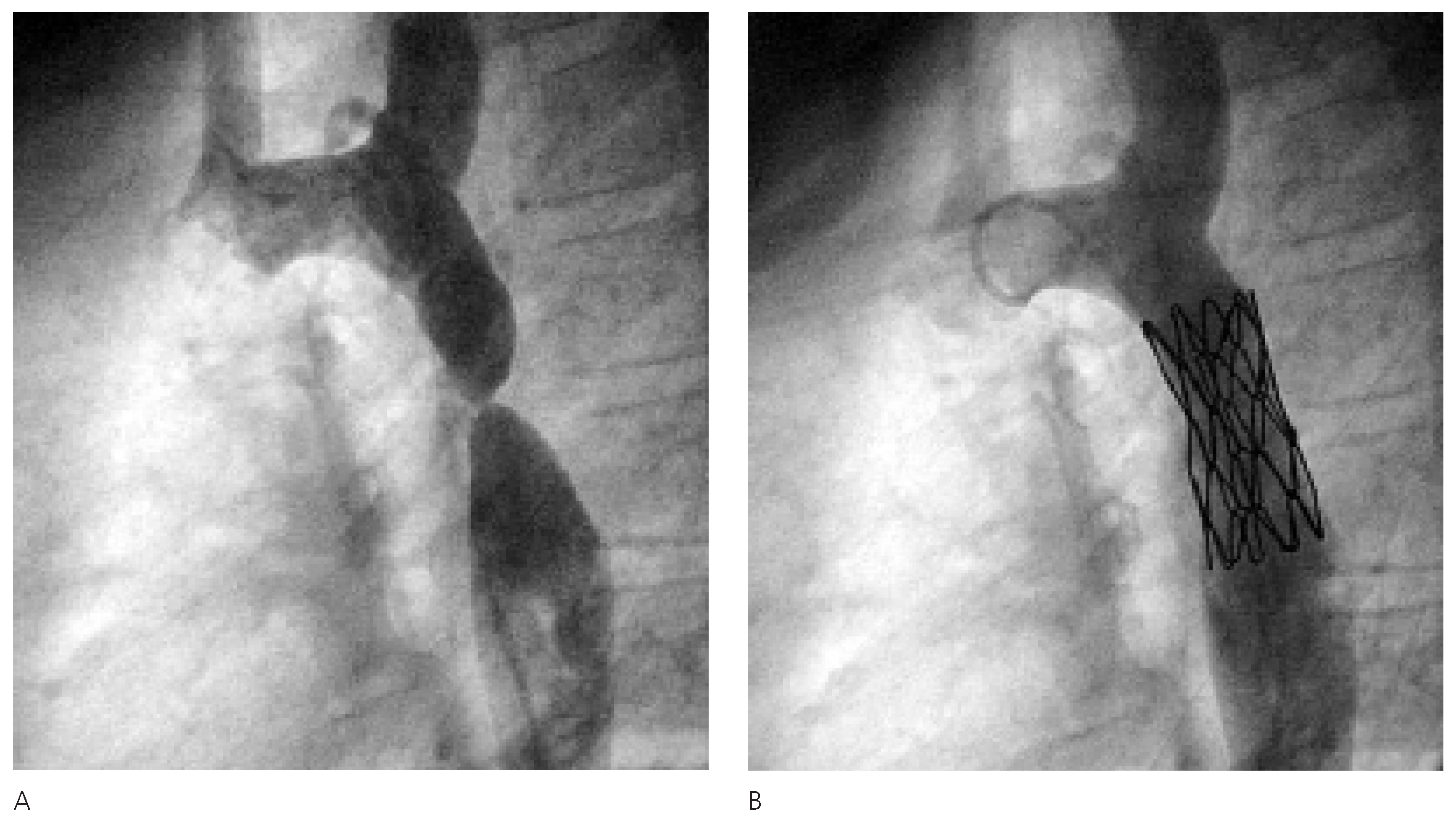 Cardiovascmed 09 00125 g003
