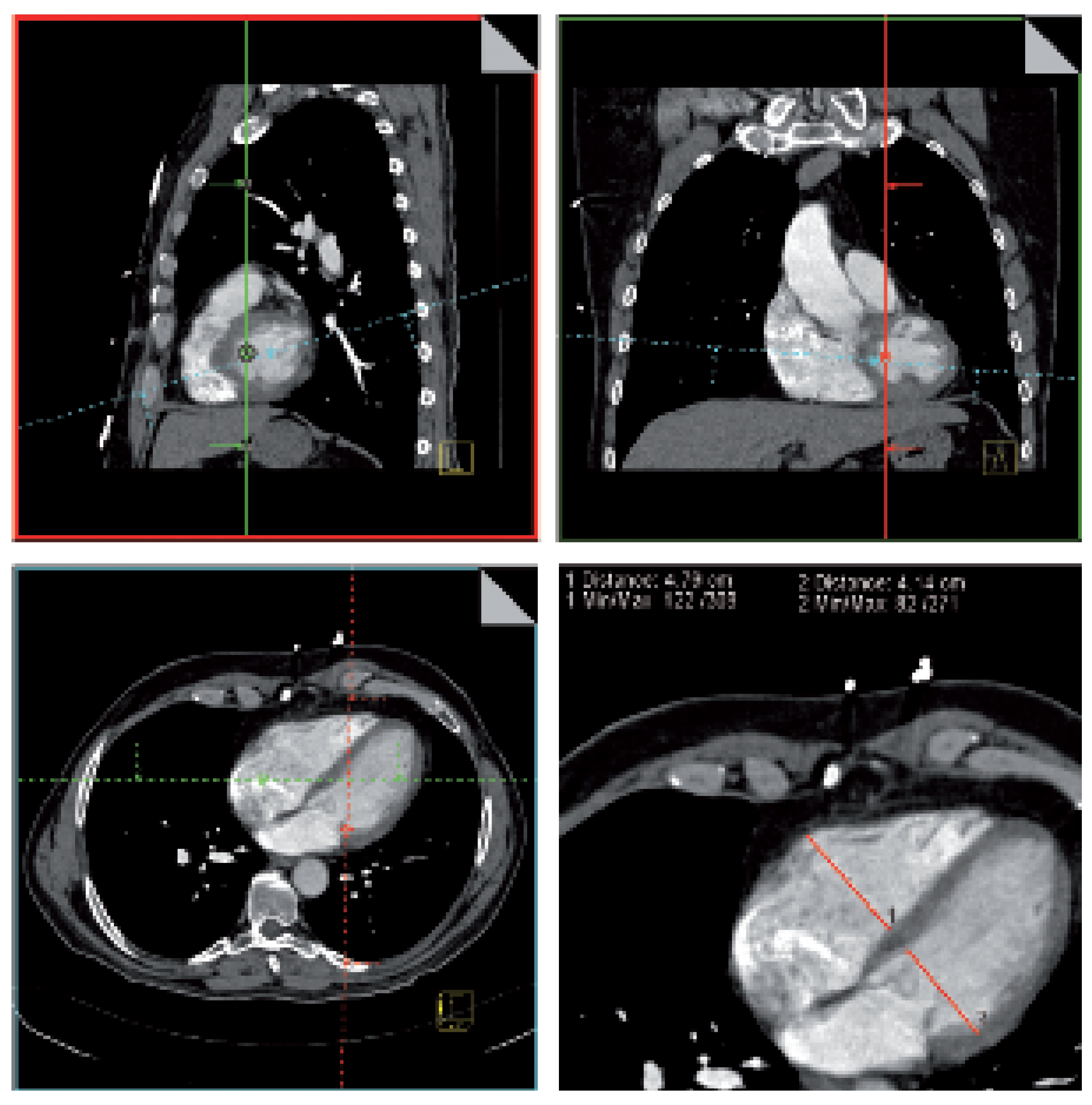 Cardiovascmed 09 00146 g005