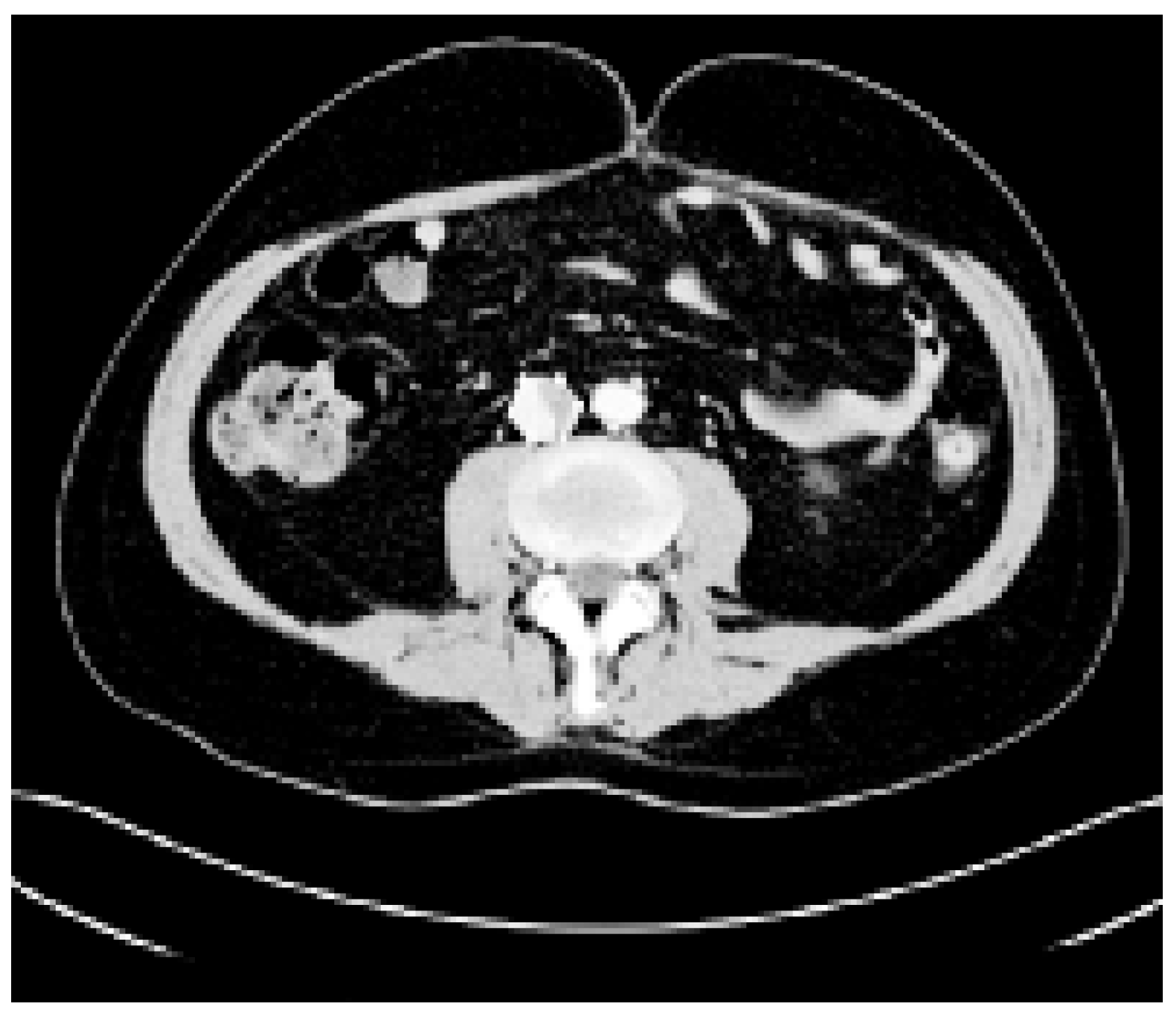Cardiovascmed 09 00162 g001 Cardiovascmed 09 00162 g001