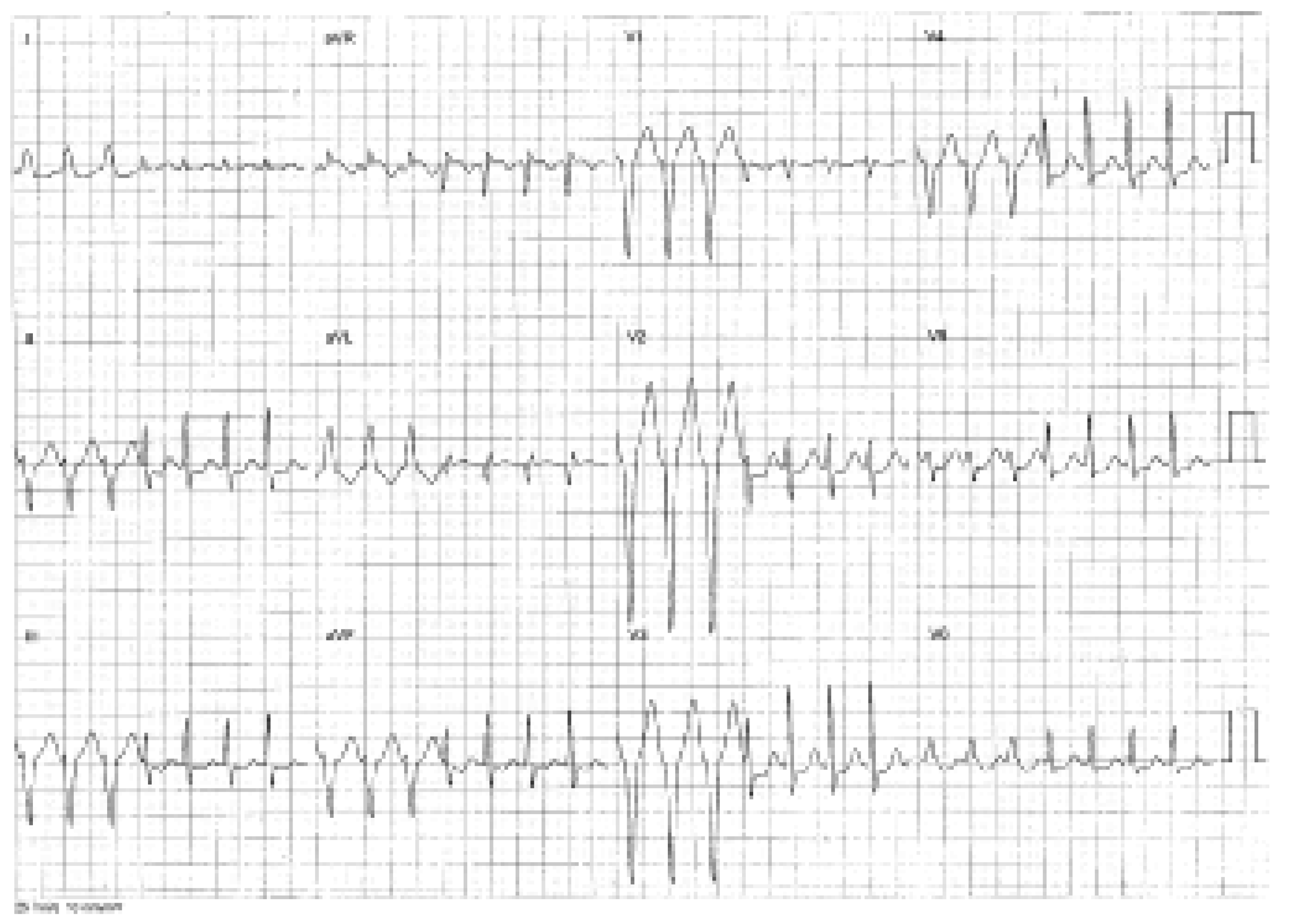 Cardiovascmed 09 00166 g001
