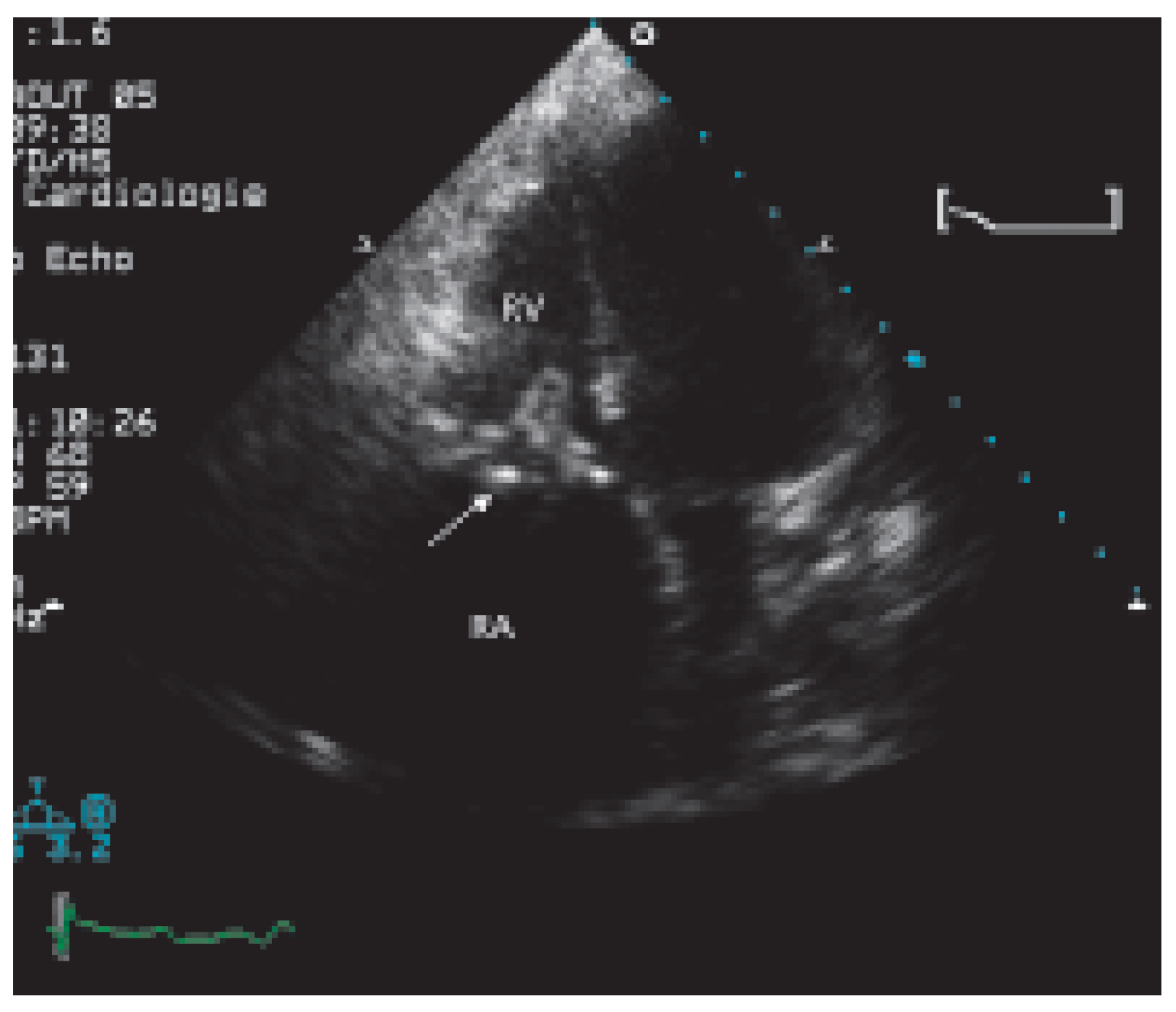 Cardiovascmed 09 00167 g001