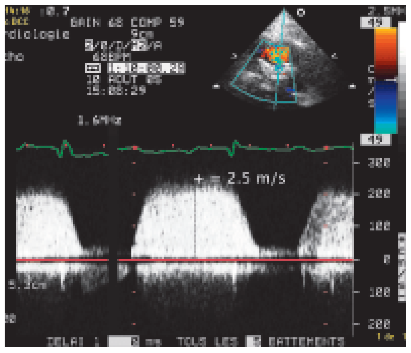 Cardiovascmed 09 00167 g002