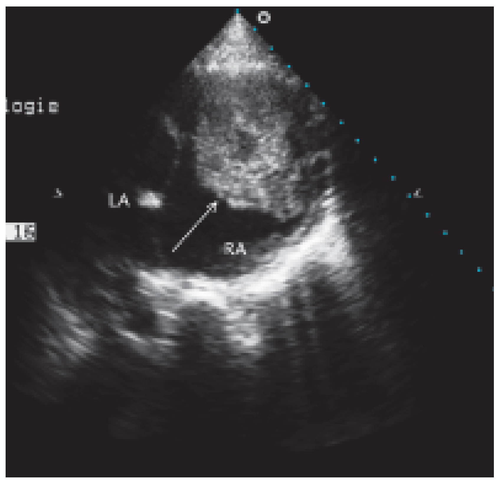 Cardiovascmed 09 00167 g004