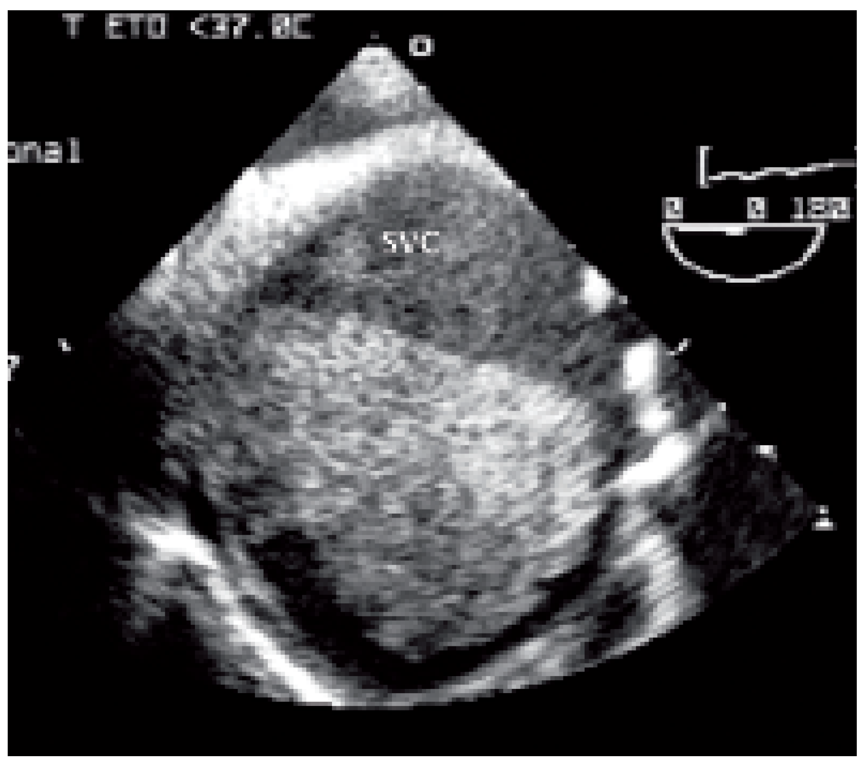 Cardiovascmed 09 00167 g005