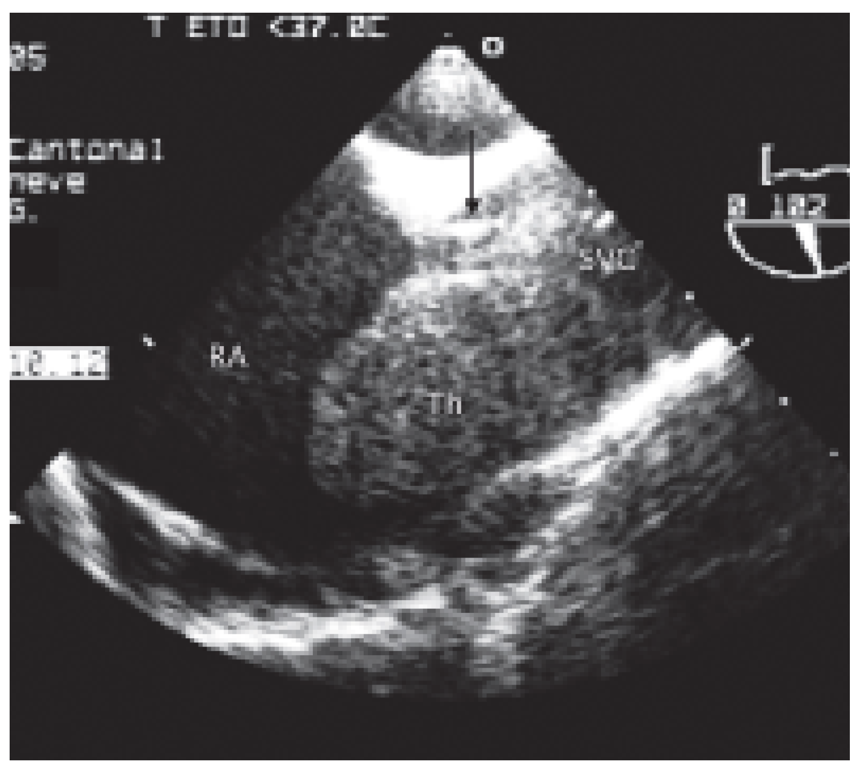 Cardiovascmed 09 00167 g006