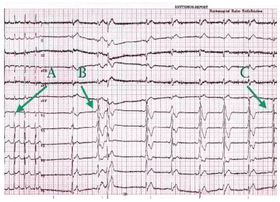 Cardiovascmed 09 00235 g001