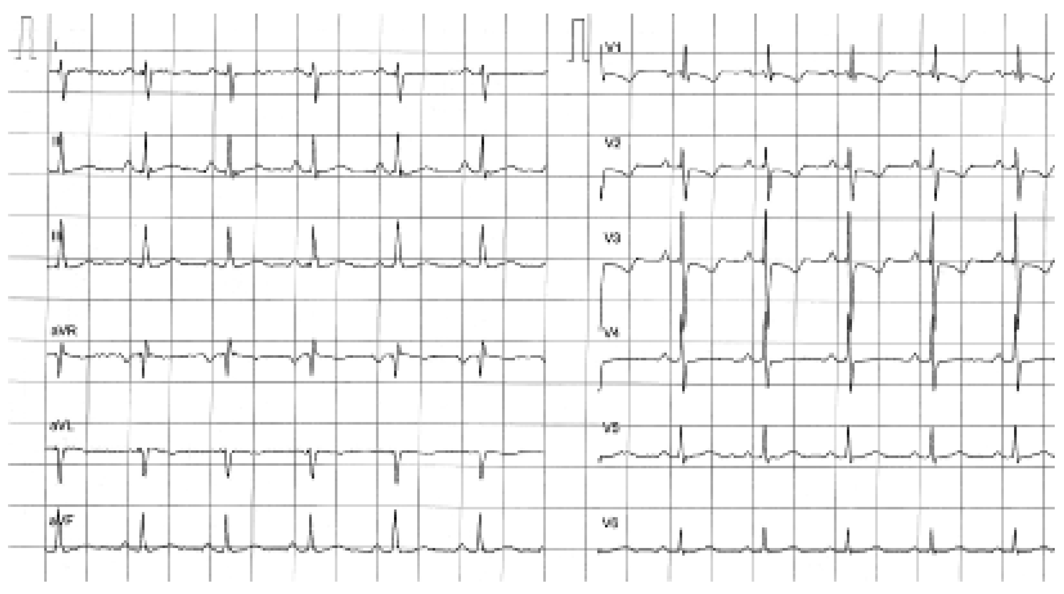 Cardiovascmed 10 00113 g001