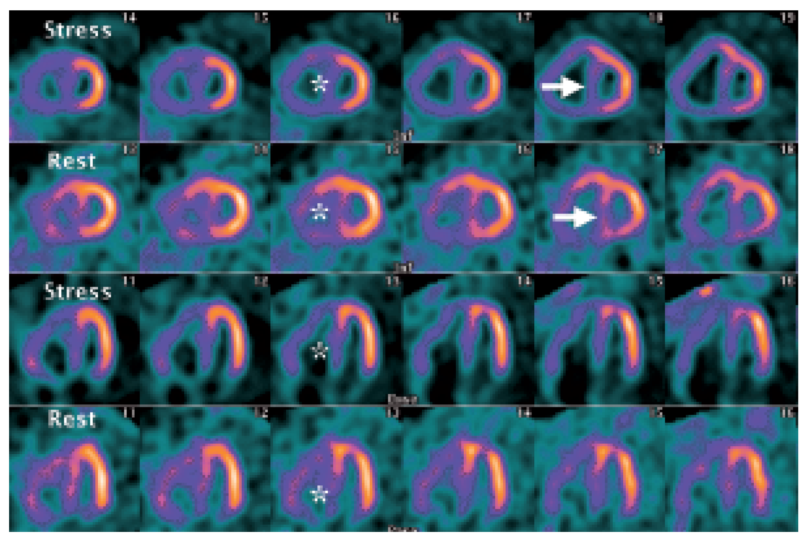 Cardiovascmed 10 00113 g002