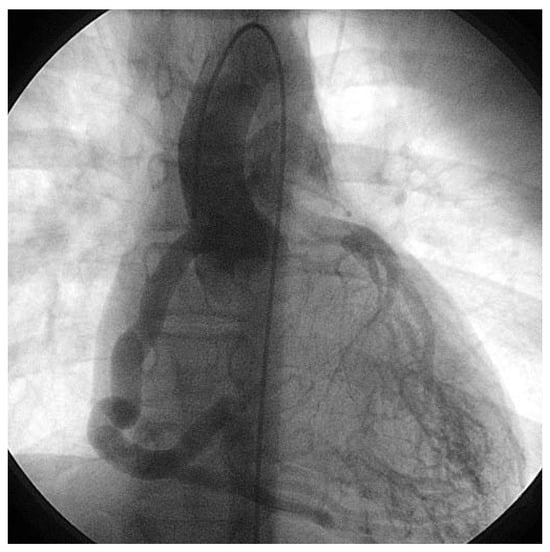 Cardiovascmed 10 00179 g001