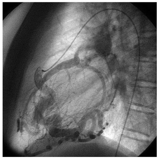 Cardiovascmed 10 00179 g002