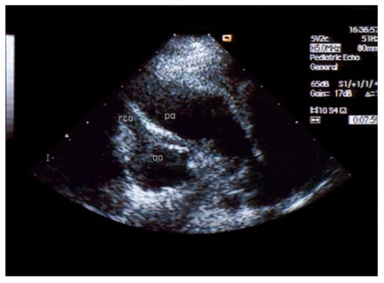 Cardiovascmed 10 00179 g003