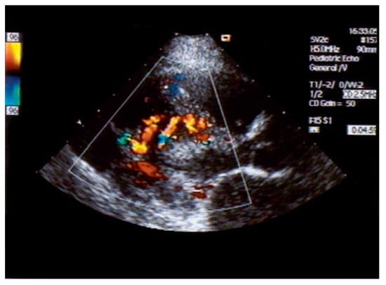 Cardiovascmed 10 00179 g004