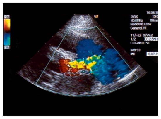 Cardiovascmed 10 00179 g005