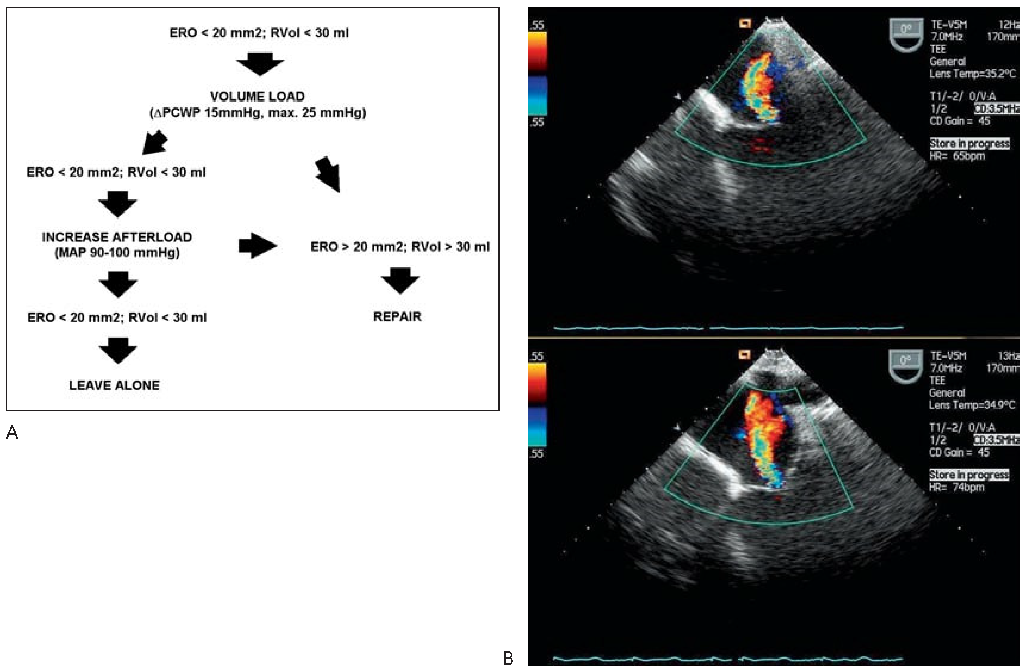 Cardiovascmed 10 00271 g002